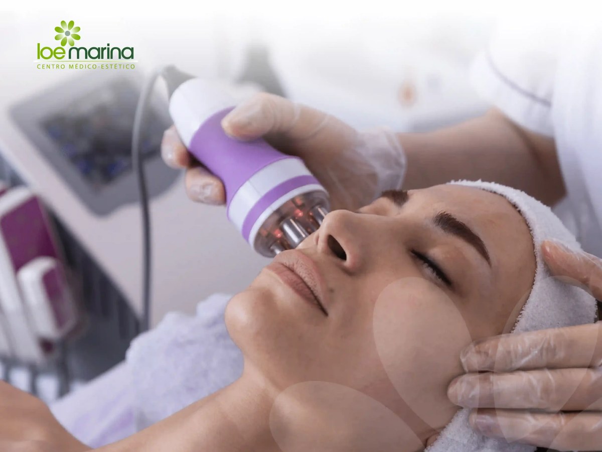 Sesión de radiofrecuencia facial en cabina